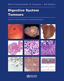 <font title="WHO Classification of Tumours of the Digestive System">WHO Classification of Tumours of the Dig...</font>