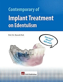 <font title="Contemporary of Implant Treatment on Edentulism">Contemporary of Implant Treatment on Ede...</font>