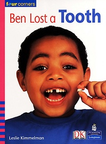 BEN LOST A TOOTH