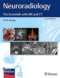Neuroradiology :the essentials with MR and CT