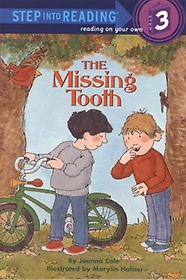 Missing Tooth
