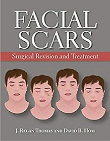 <font title="Facial Scars: Surgical Revision and Treatment">Facial Scars: Surgical Revision and Trea...</font>