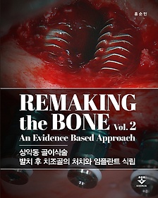 Remaking the Bone Vol 2