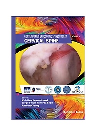 <font title="Cervical Spine (Contemporary Endoscopic Spine Surgery)">Cervical Spine (Contemporary Endoscopic ...</font>