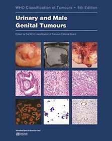 <font title="Urinary and Male Genital Tumours WHO Classification of Tumours, 8">Urinary and Male Genital Tumours WHO Cla...</font>